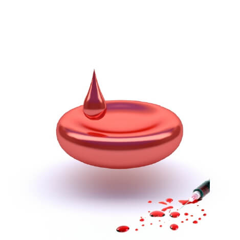 krwinka czerwona-strzykawka z krwia do zabiegu regeneris PRP